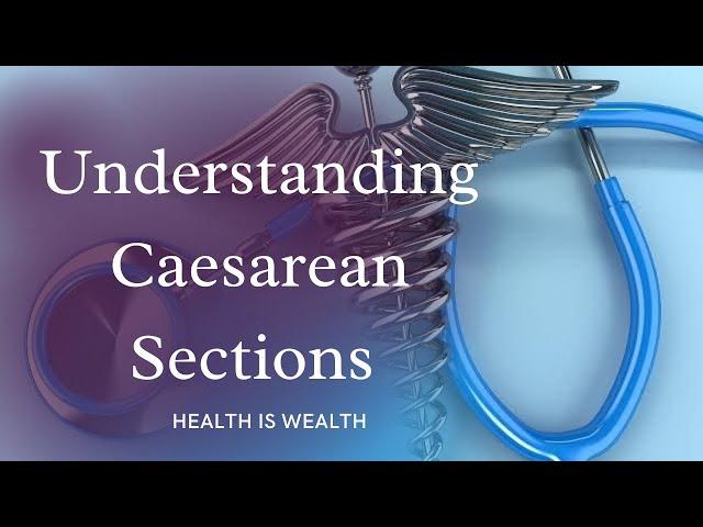 Understanding Caesarean Sections