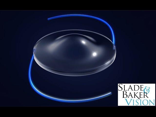 Slade & Baker Vision: How the Light-Adjustable Lens Works