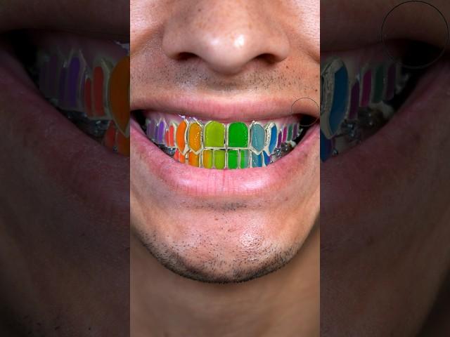 My Custom Grillz with @johnnydangandco