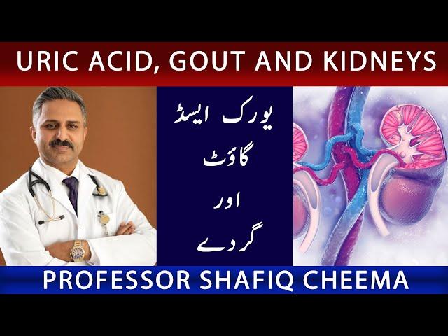 Uric Acid, Gout and Kidneys | NephChat With Dr Shafiq Cheema