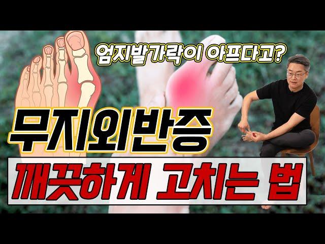 엄지발가락 통증! 간단하게 해결하는 법!  - 김범수의 100세 시대 두 발 혁명 #2 ㅣ무지외반 발가락통증 발통증 스트레칭 발근육강화 발코어근육