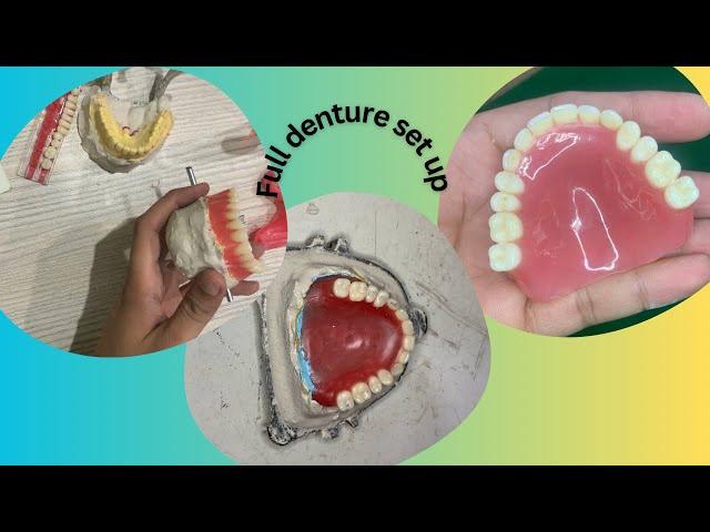 Full denture wax up #dentistry #dental #toothfairy #denture ​⁠@Umairazeem8553