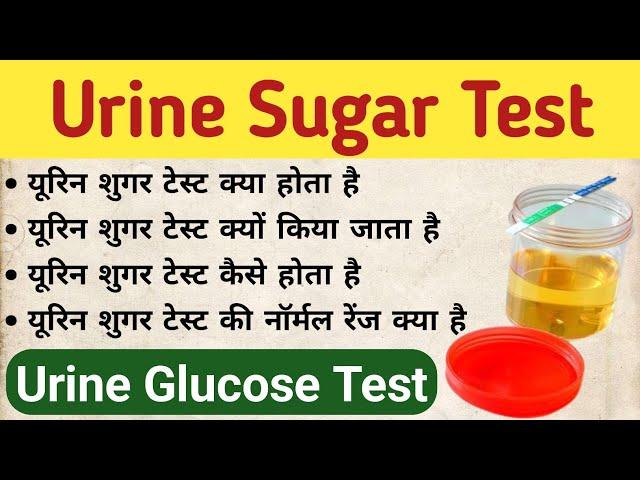 Urine Sugar test in hindi | यूरिन शुगर टेस्ट क्यों किया जाता है