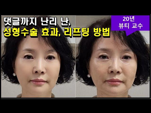 늘어진 턱선 즉각 잡아주는, 혼자 알기 아까운 리프팅 효과