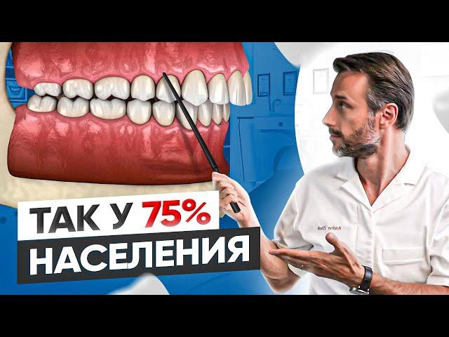 Самый популярный вид неправильного прикуса у человека #3 | Дистальный прикус