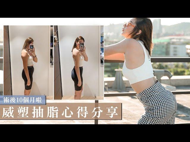 整整瘦了一圈！威塑抽脂想瘦哪就瘦哪｜I got Vaser liposuction.