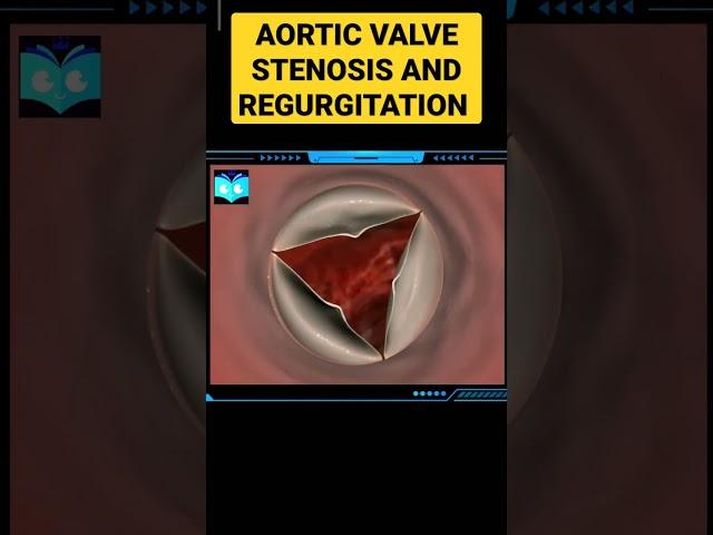 Aortic value stenosis and regurgitation. #studyanimated #biology #animation #science