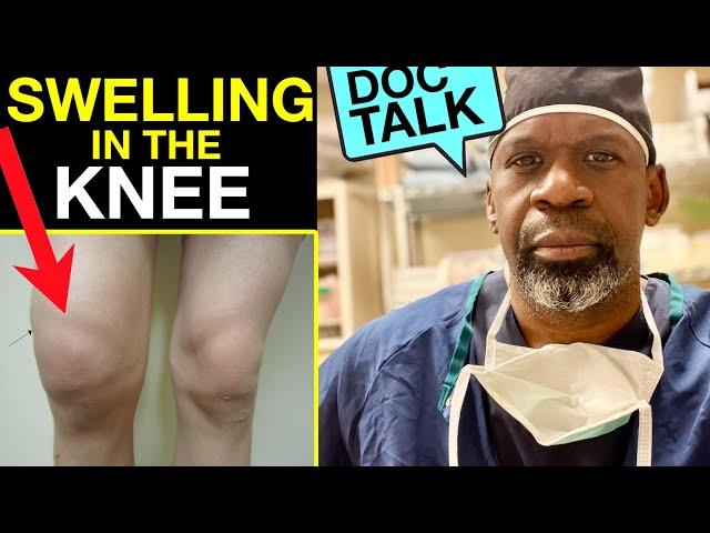 SWELLING IN THE KNEE | Why You Get It & How To Treat It With Orthopedic Surgeon Dr. Chris Raynor