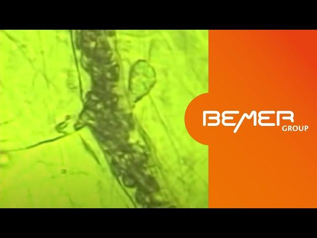 The BEMER Effect - microscopic demonstration of the effect on microcirculation | EN