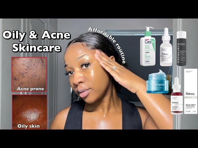 SKINCARE ROUTINE FOR OILY ACNE-PRONE SKIN | A routine for smooth & clear Skin ‼️