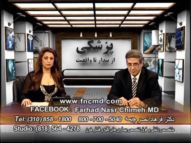 واریس دکتر فرهاد  نصر چیمه Varicosis Dr Farhad Nasr Chimeh