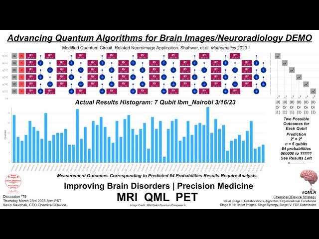 Advancing Quantum Algorithms for Brain Images Neuroradiology DEMO