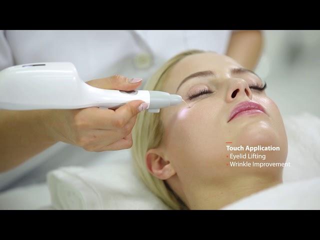 PURISMA - Plasma Skin Rejuvenation by Daeyang Medical