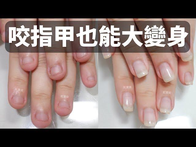 The nail biting can also be transformed into a big body - correcting the nail and making art nails