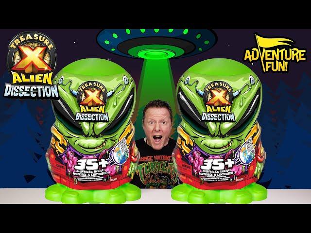 Treasure X Alien Dissection Mega Alien Dissection Adventure Fun Toy review!