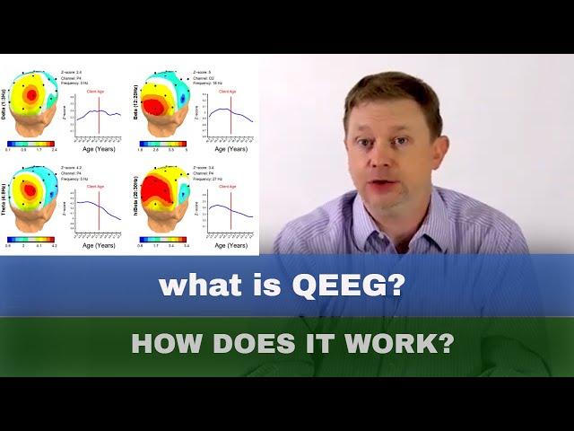 QEEG & s-LORETA Brain Mapping Basics Explained