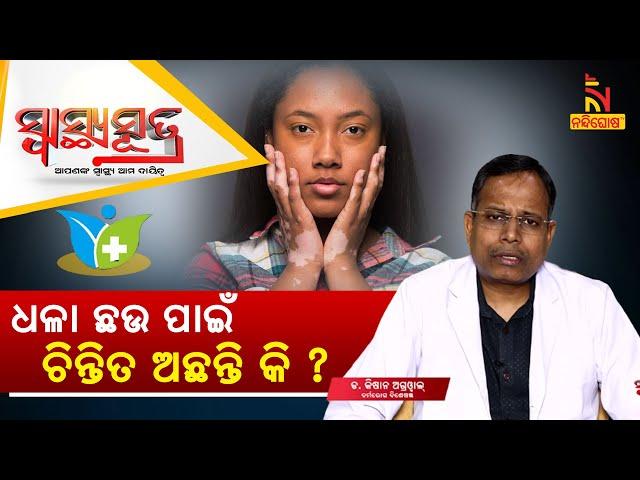 ଧଳା ଛଉ ବଂଶଗତ ରୋଗ କି ? ଧଳା ଛଉ: କାରଣ ଓ ଚିକିତ୍ସା | Vitiligo Causes  | Dr Kishan Agrawal | SwasthyaSutra