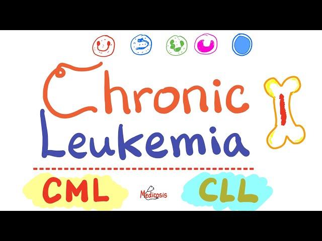 Chronic Leukemias - CML and CLL  - Hematology / Oncology