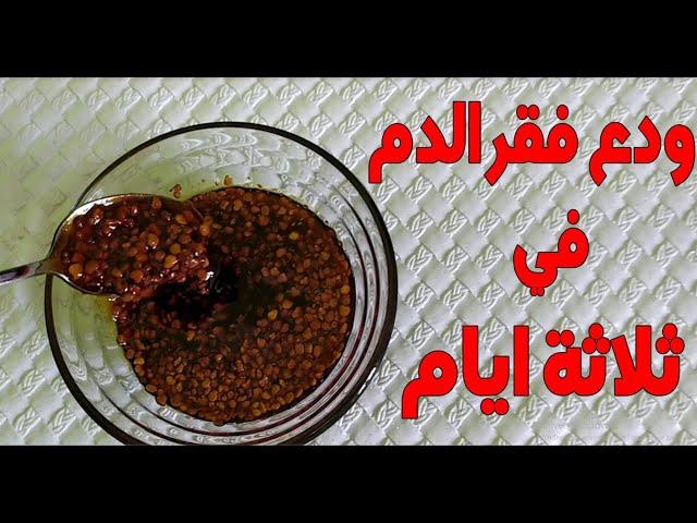 كنوز ربانية لعلاج فقر الدم ونقص الحديدفي 3 ايام حتى لو كان نقصه حاداً ، شحوب البشرة و تقوية المناعة