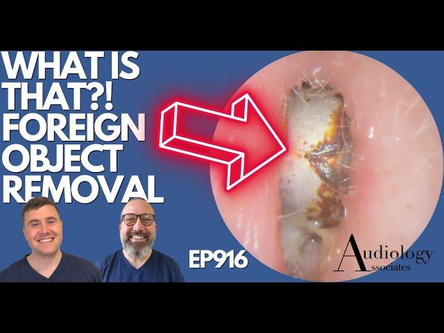 WHAT IS THAT?! FOREIGN OBJECT REMOVAL - EP916