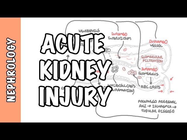 Acute Kidney Injury (AKI) - prerenal, intrarenal and postrenal causes and pathophysiology