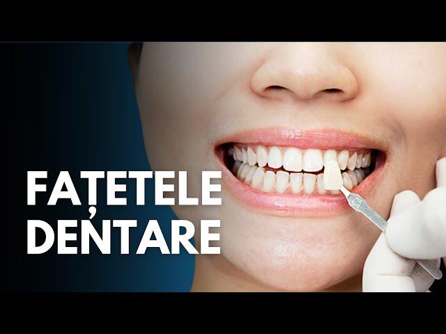 Fațetele dentare: Avantaje și dezavantaje explicate de Dr. Gabriel Leuștean | Sănătate cu Prioritate