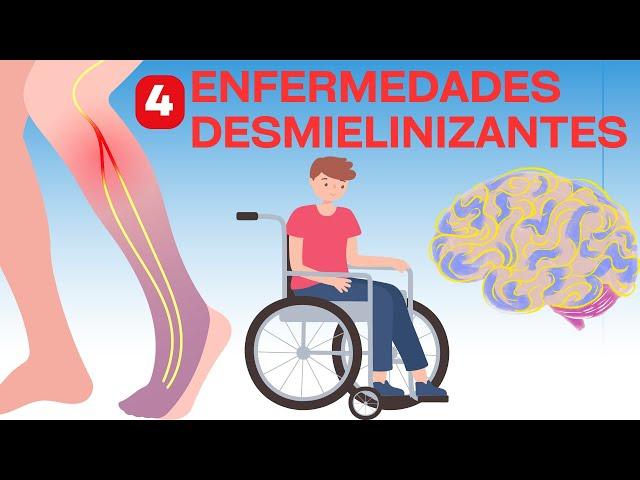 Las 4 enfermedades desmielinizantes más importantes