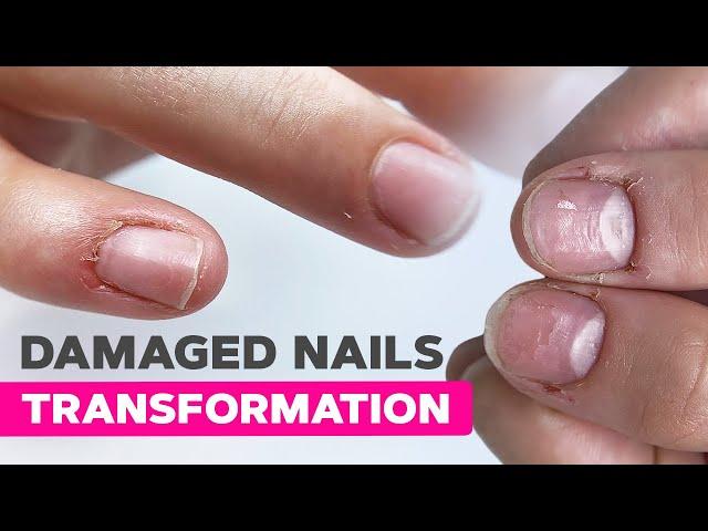 The BEST Nail Transformation Strategy Nobody Tells You | Dual Form Nail Extensions