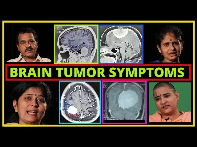 What are the symptoms of Brain Tumour?