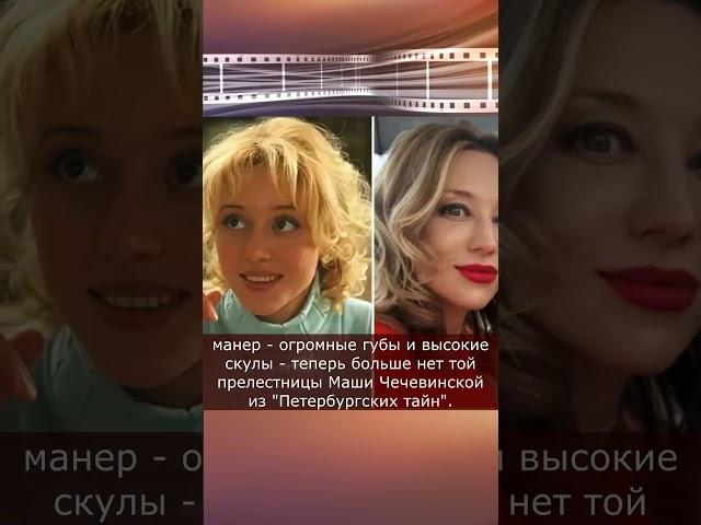 Пластика изменила ее до неузнаваемости: Дарья Волга, звезда "Петербургских тайн" #shorts