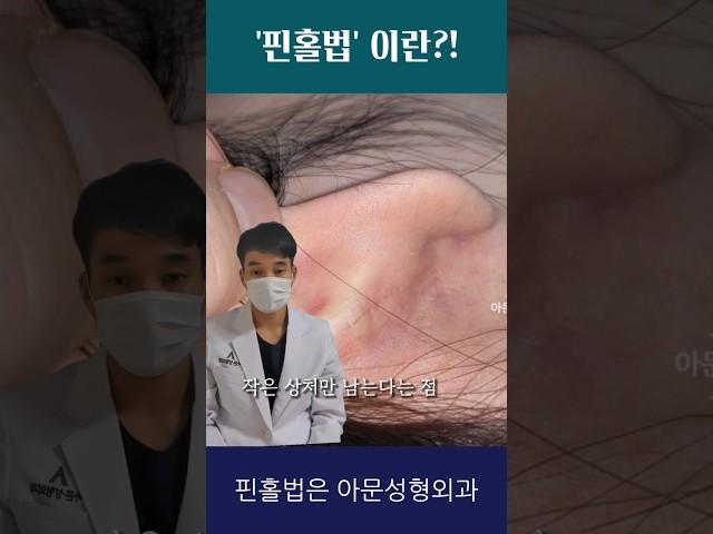 표피낭종 핀홀법이란?! (피지낭종 수술 흉터)[아문TV]