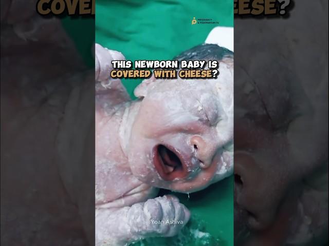 Newborn Covered In Cheese??? 