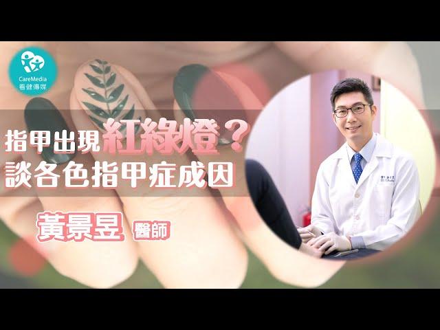 【指甲小學堂】指甲亮起紅綠燈！我該怎麼辦？｜ft 群英楊麗珍黃景昱皮膚科診所 黃景昱 醫師