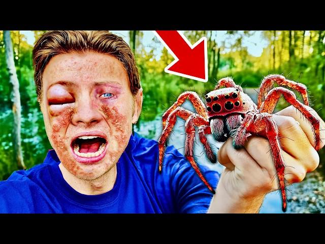 DEADLY SPIDER BIT ME!! *allergic reaction *