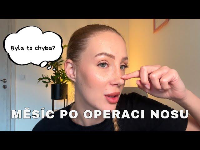 MĚSÍC PO OPERACI NOSU | jsem šťastná nebo toho lituju?