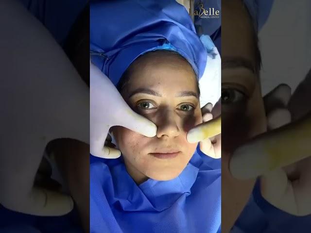 مع جميلات مركز لابيل الطبي ب ابو ظبي عملية نقل الدهون الذاتية مع الجراح الايطالي دكتور ريزا
