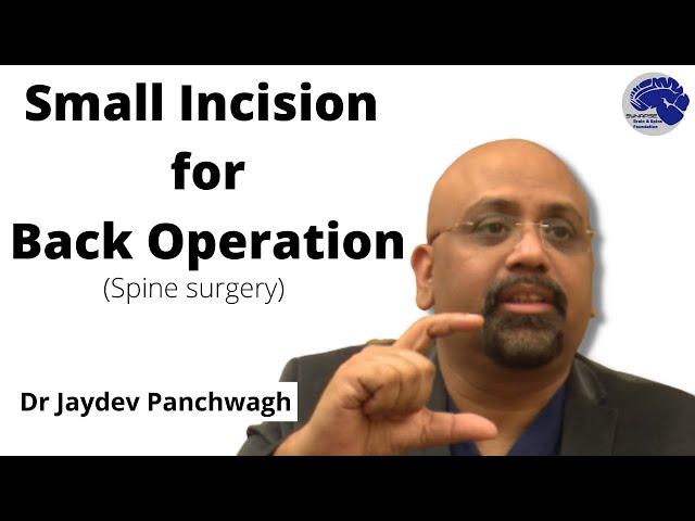 Small incision spine operation. Dr Jaydev Panchwagh. Spine surgeon Pune. 2021