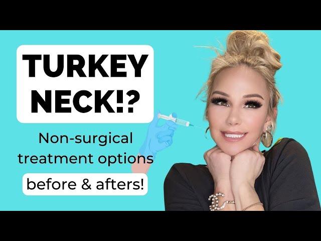 TURKEY NECK!? How to tighten saggy neck skin, tech neck, non surgical options!