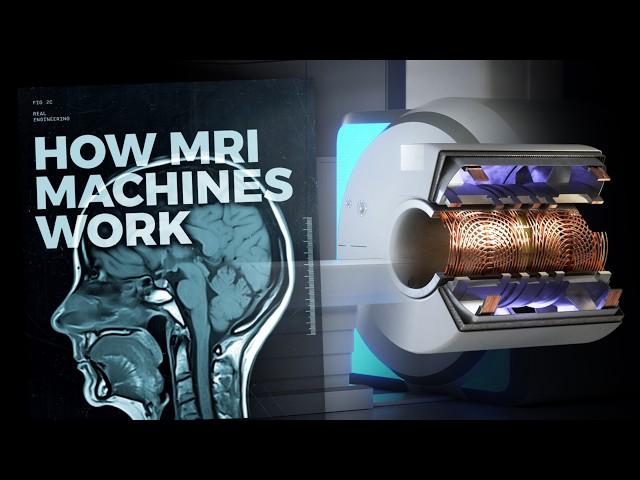 The Insane Engineering of MRI Machines