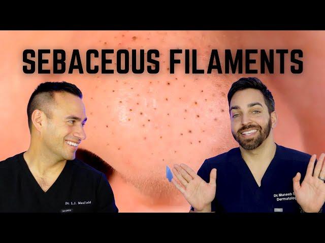 Black Dots on the Nose? Here's How To Treat Sebaceous Filaments