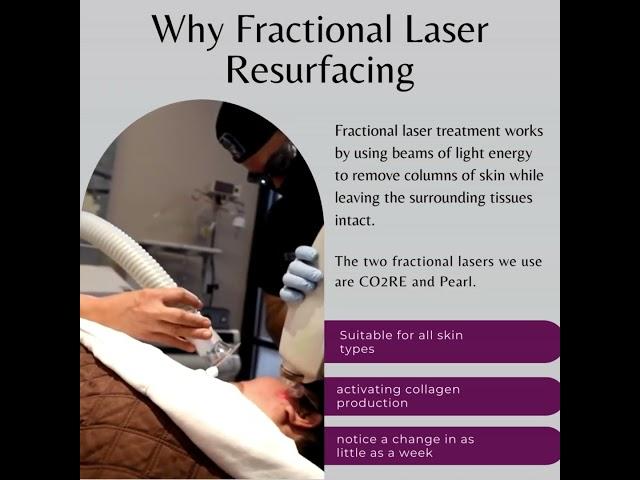 Fractional Laser Skin Resurfacing