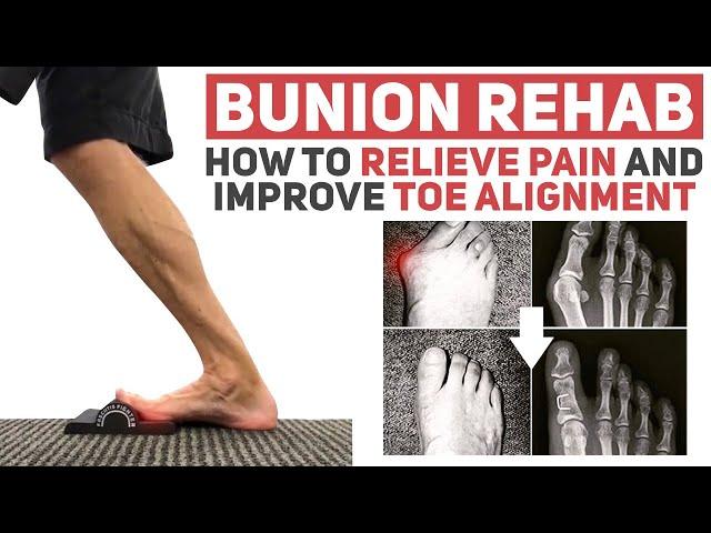 Bunion Rehab - How to Stretch and Mobilize Your Big Toe