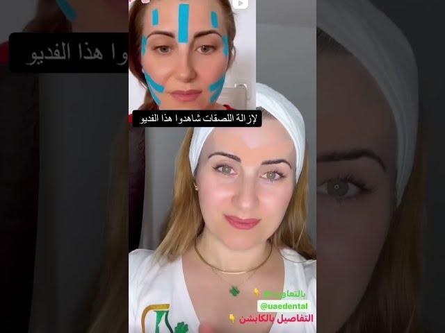 بوتوكس طبيعي لشد تجاعيد بين الحاجبين    #shorts #faceliftmassage
