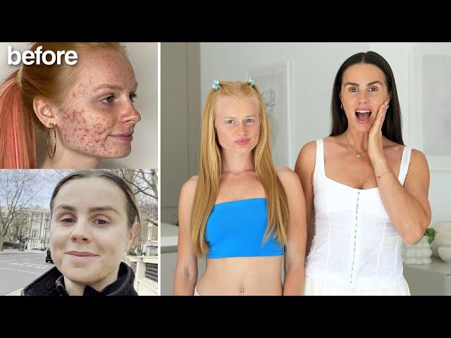 HOW WE QUIT SUGAR! Mother & Daughter Glow Up