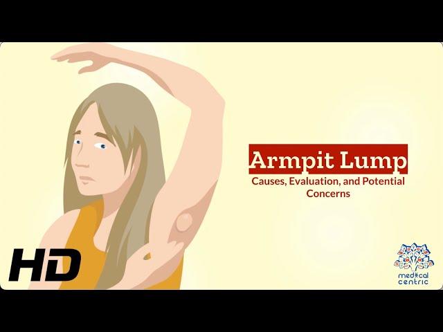 Unveiling the Mystery: Understanding Armpit Lumps