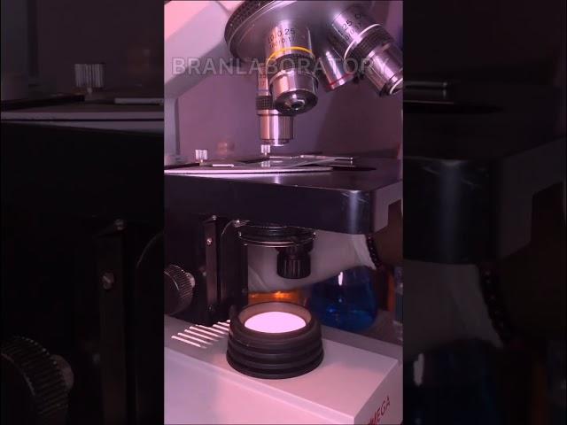 Trichomoniasis Vaginalisis; One of the many protozoa that causes itching when you have infection UTI