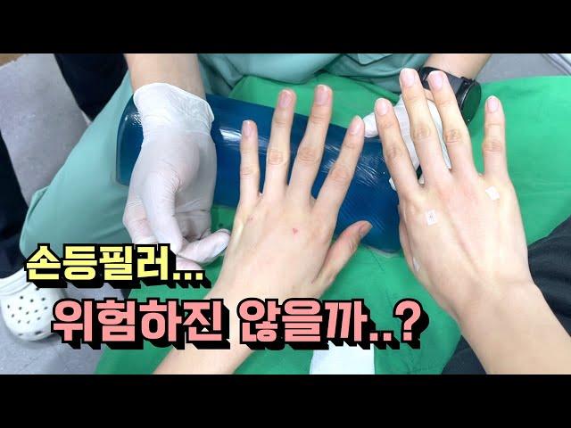 손등필러 시술 후 주의할 점은? 마르고 주름진 손 관리법ㅣ모즈의원- 손승용원장