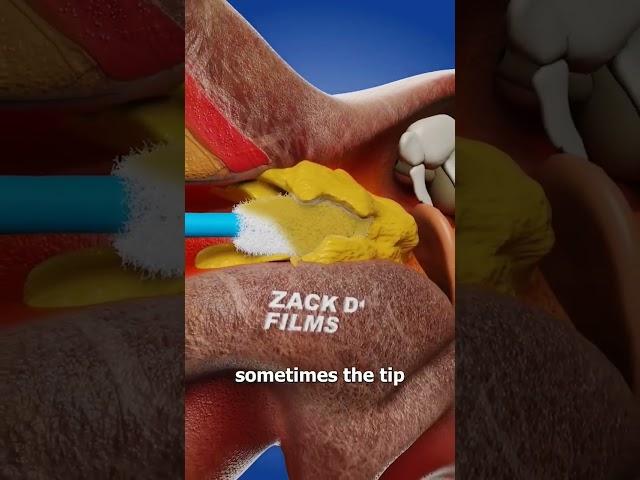 POV: When the Tip of the Cotton swab gets stuck #funny #comedy #zackdfilms #