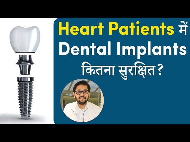 क्या Heart Patients Dental Implants द्वारा फिक्स दांत लगवा सकते है? |Dr. Ankit Khasgiwala | Seraphic