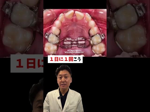 ごついですが効果はバツグンです️#蒲田 #矯正 #矯正歯科 #歯医者 #歯並び
